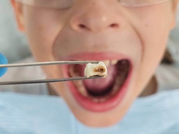 Best Emergency Dental Care for Trauma or Injury in Stockton, UT